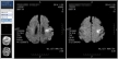 MRIの画像（2×1）